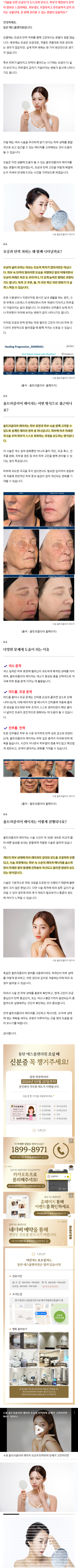 동탄리프팅 tbble